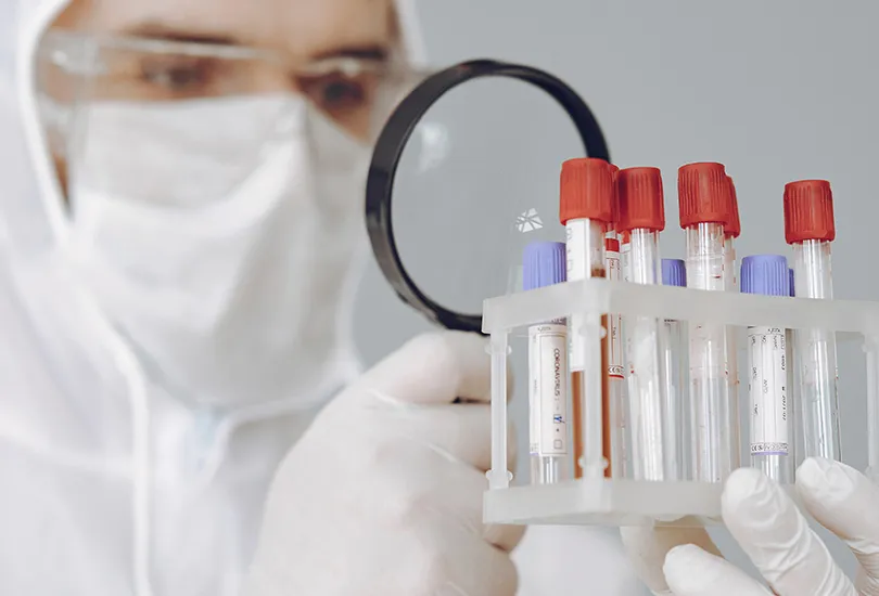 ANS inclui teste sorológico para Covid 19 no rol de coberturas obrigatórias