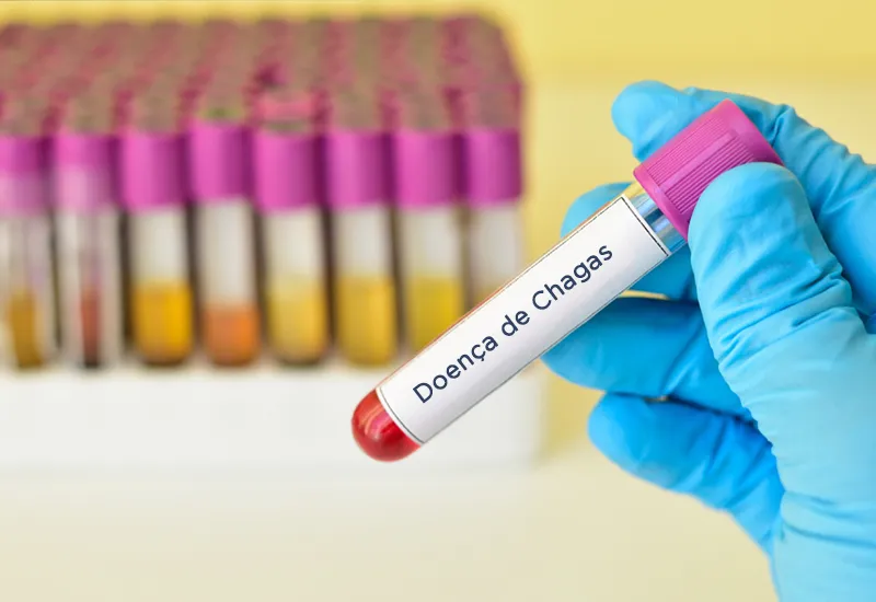 Avaliação de testes sorológicos comerciais para a Doença de Chagas com padrões de referência da OMS