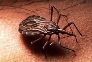 Caso de Doença de Chagas mostra a importância de um diagnóstico precoce
