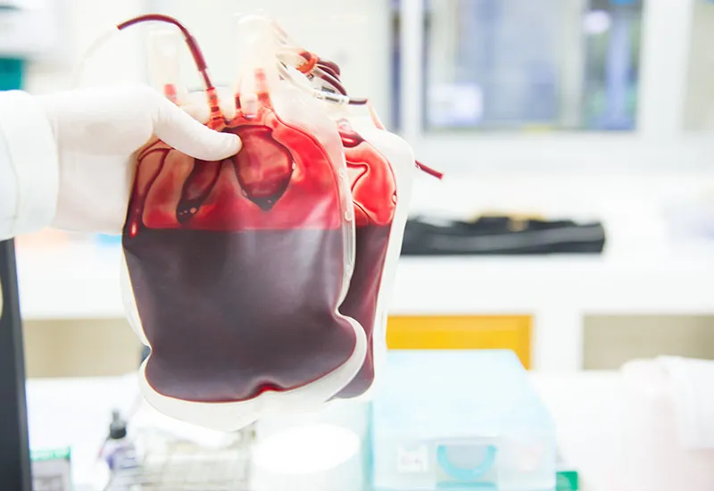 Consulta Dirigida sobre transporte de sangue e componentes (Serviços de Hemoterapia)