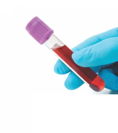 Novas Amostras para Controle Interno da Qualidade