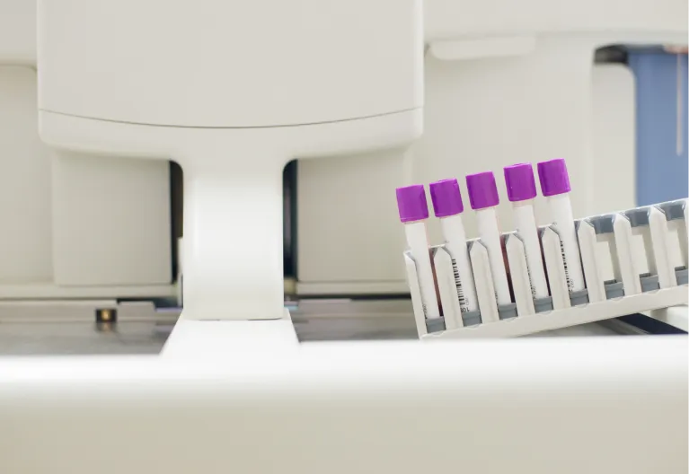 Parâmetros hematológicos comparados em pacientes com psoríase