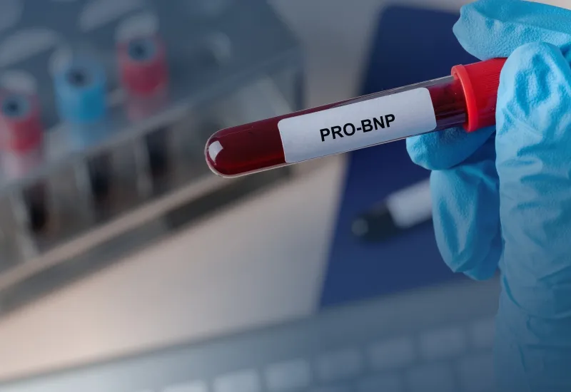 PNCQ lança amostras-controle para PRO-BNP