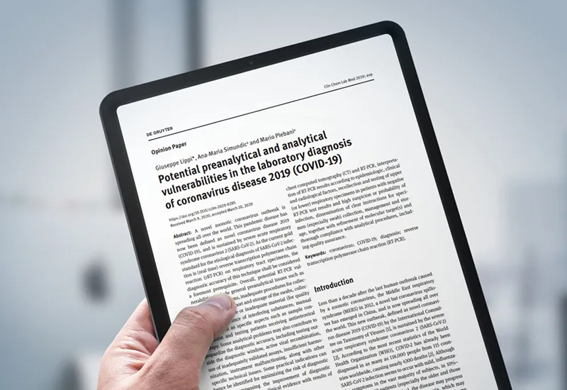 Potenciais vulnerabilidades pré-analíticas e analíticas no diagnóstico laboratorial da COVID-19
