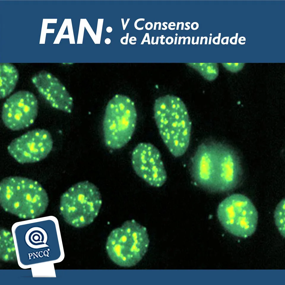 Saiu o V Consenso de Autoimunidade