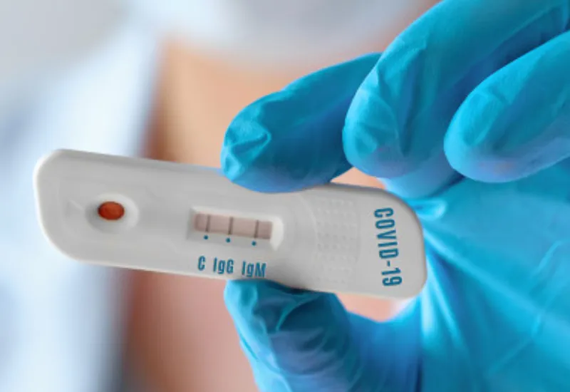 RECOMENDAÇÕES DA AACC PARA TESTE DE SOROLOGIA PARA O SARS-COV-2